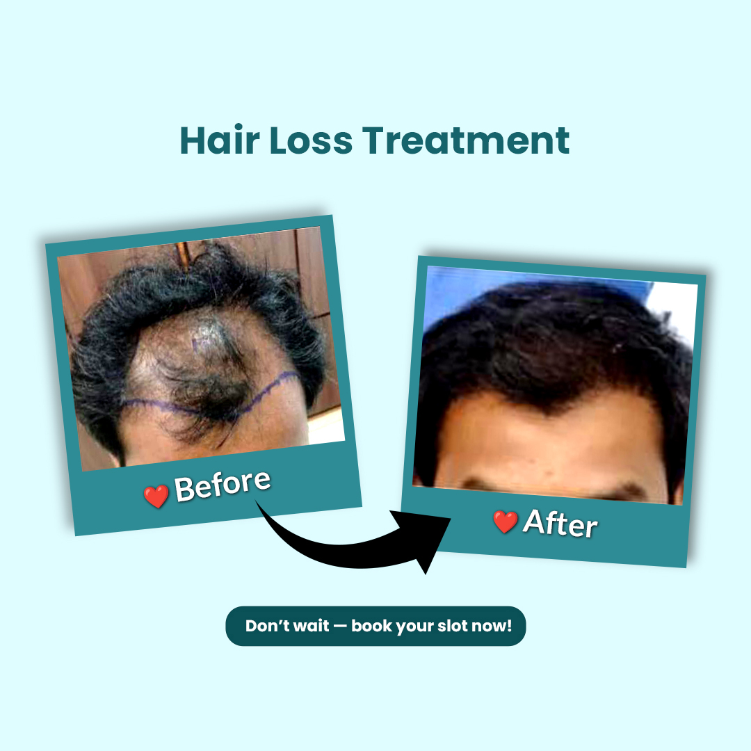 Before & After 2