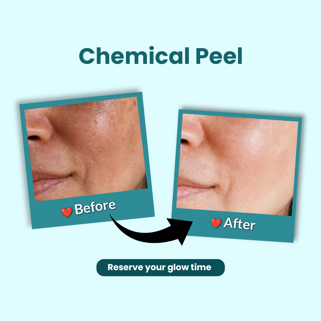Before & After 5