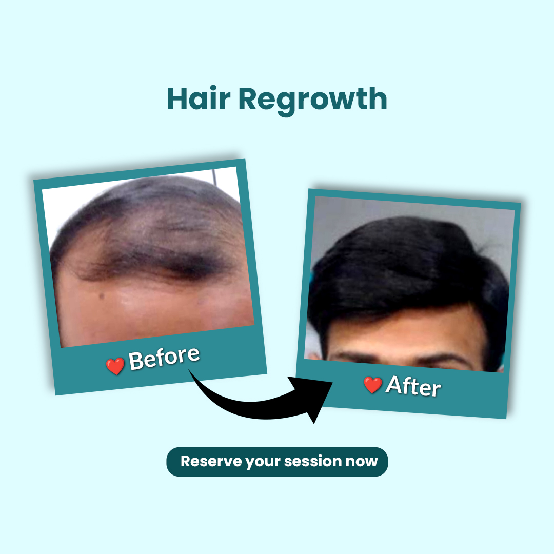 Before & After 4